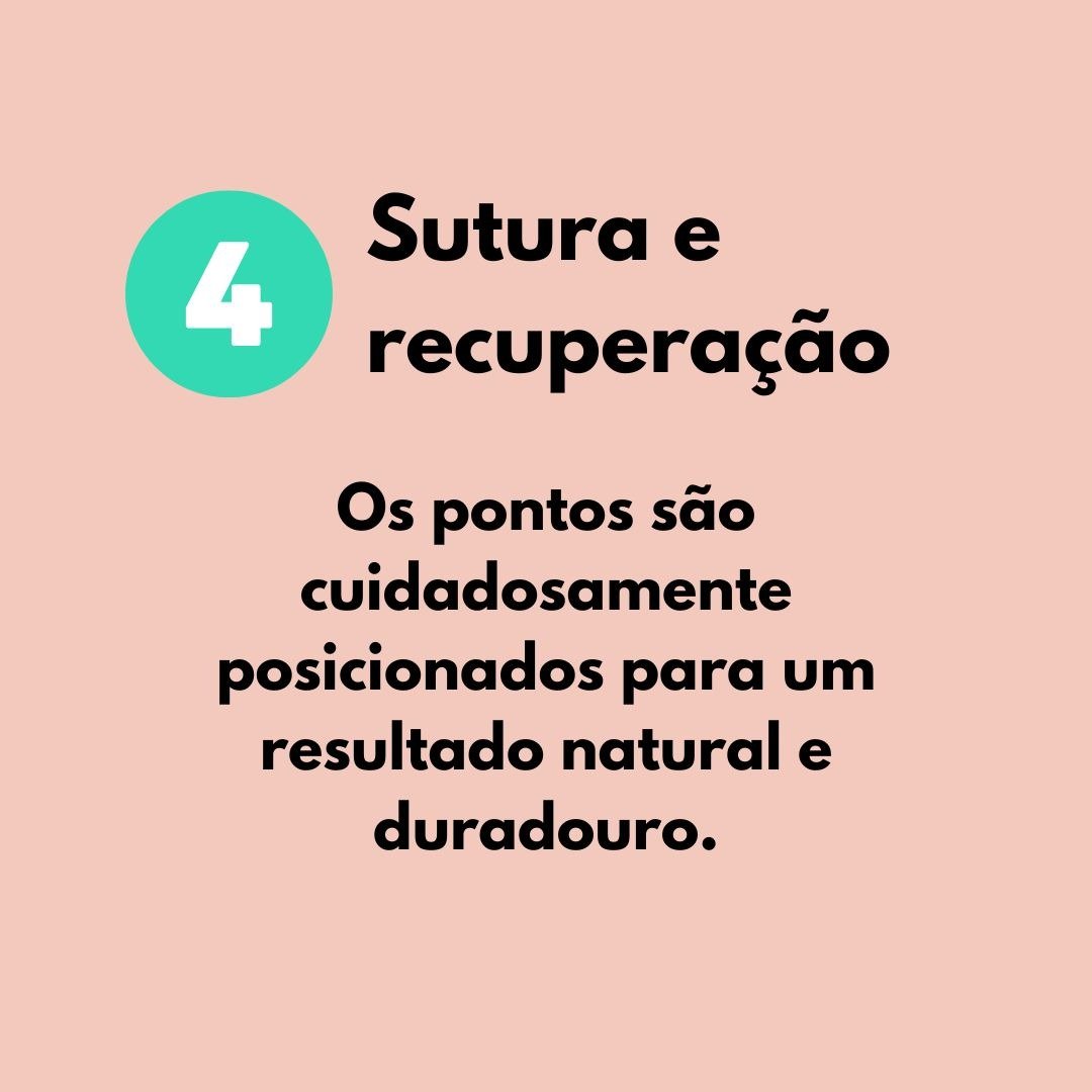 O número 4 em um círculo verde e texto sobre a otoplastia